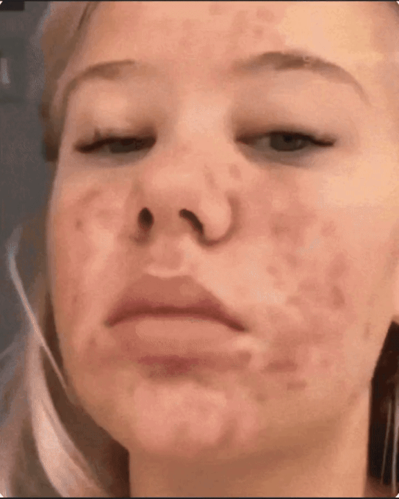 120201213202560535_videos_0online-video-cutter.com2-ezgif.com-resize (3)